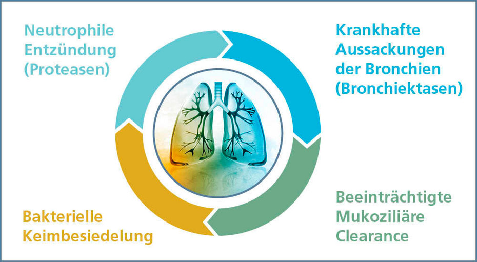 Teufelskreis bei Bronchiektasie