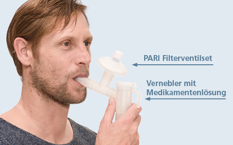 Anwendung des PARI Filterventilset Anwendung des PARI Filterventilset